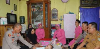 Camat Kisaran Timur Bersama Kapolres Asahan Kunjungi Warga Pengidap Hidrosefalus