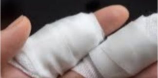 Seorang Pria Menjadi Korban Begal Di Sukatani, Jari Nyaris Putus Terkena Celurit