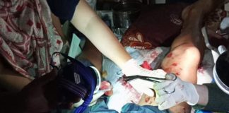 Serangan Buaya Kembali Terjadi di Buton Tengah, Satu Warga Alami Luka Parah