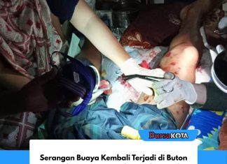 Serangan Buaya Kembali Terjadi di Buton Tengah, Satu Warga Alami Luka Parah