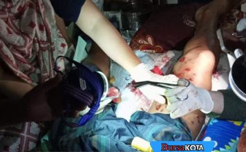 Serangan Buaya Kembali Terjadi di Buton Tengah, Satu Warga Alami Luka Parah