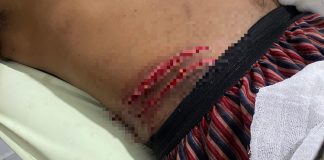 Warga Desa Dahiango Jadi Korban Serangan Buaya di Laut Bala-Bala