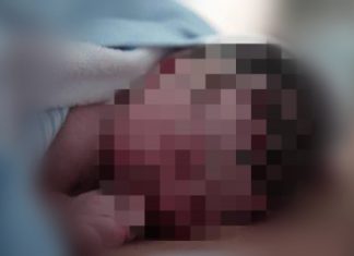 Gadis 14 Tahun Melahirkan Seorang Diri di Anambas, Polisi Periksa Seorang Pria