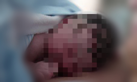 Gadis 14 Tahun Melahirkan Seorang Diri di Anambas, Polisi Periksa Seorang Pria